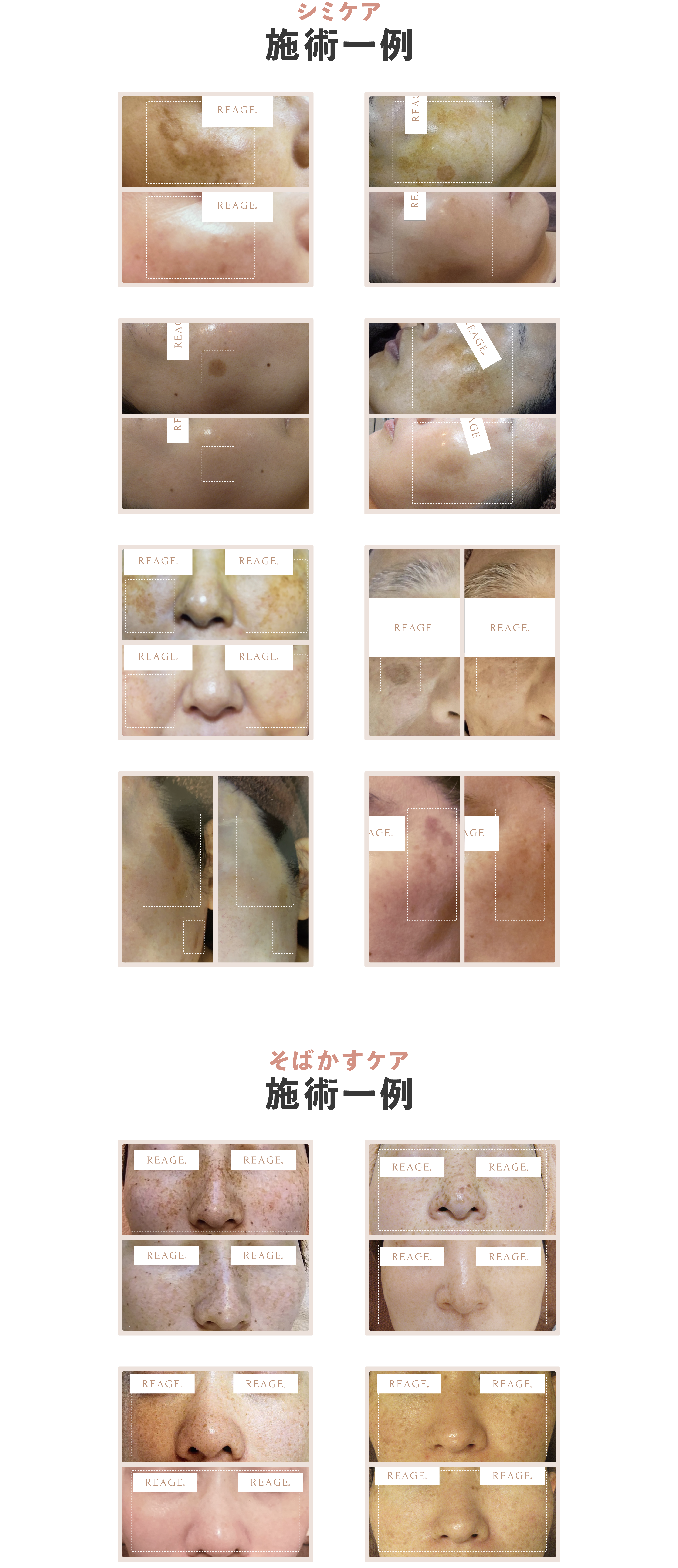 施術一覧