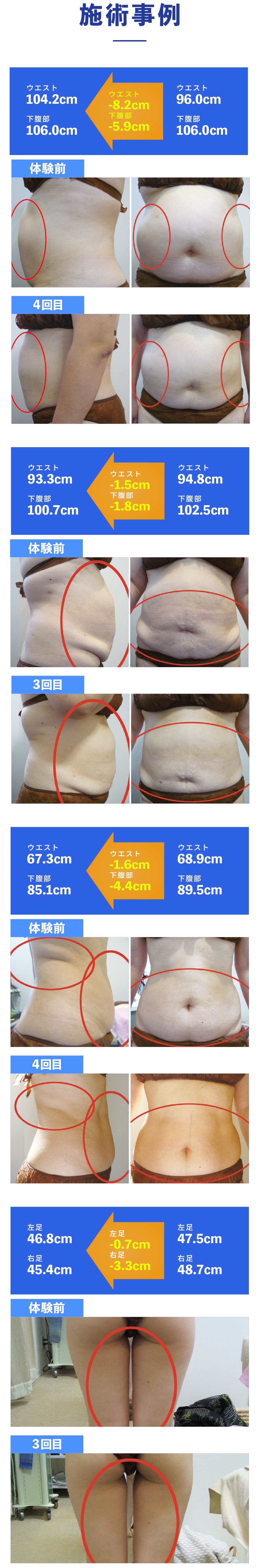 施術実例